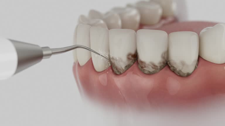 Reliable Teeth Cleaning And Checkup contractor in Oktibbeha County County, MS by Dentist Open Now